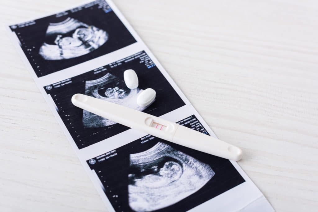 pills and pregnancy test on ultrasound image
